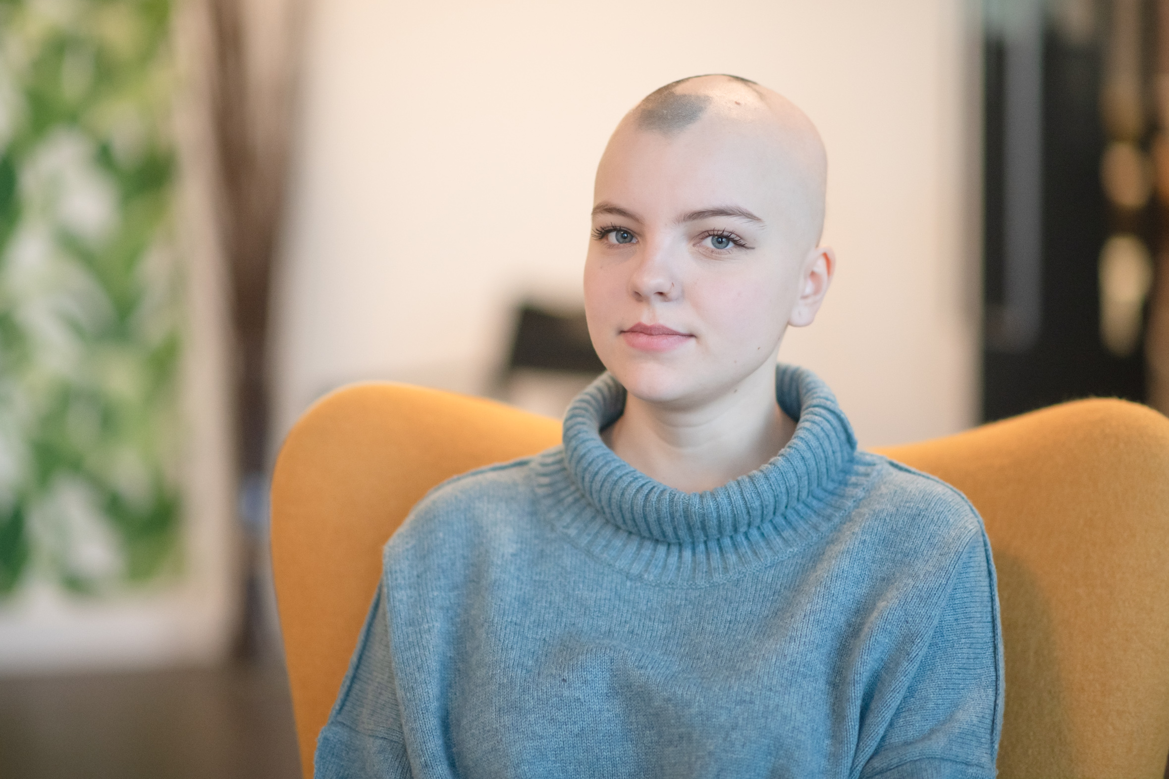 woman with alopecia